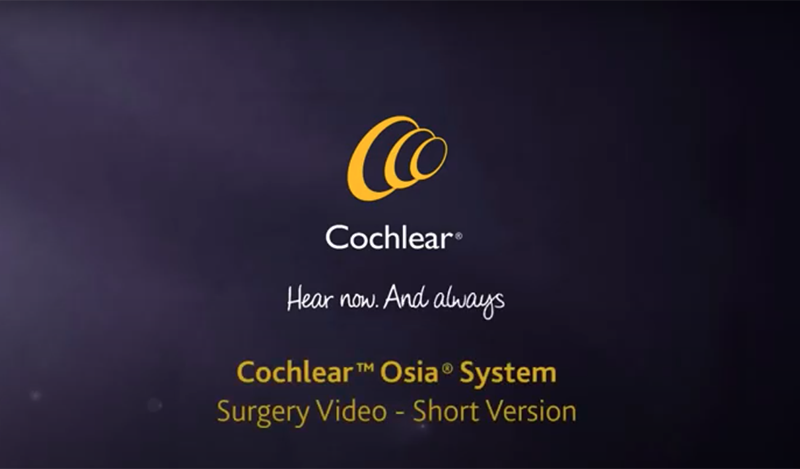 Vidéo sur l’opération pour la mise en place du système Osia de Cochlear, version courte