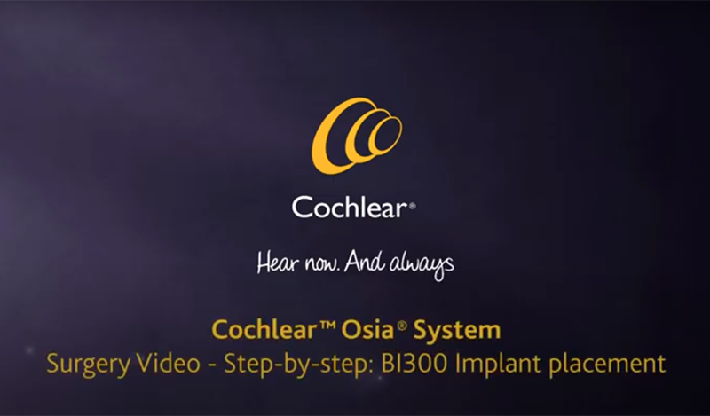 Osia-Surgery-Video-BI300-Implant.png