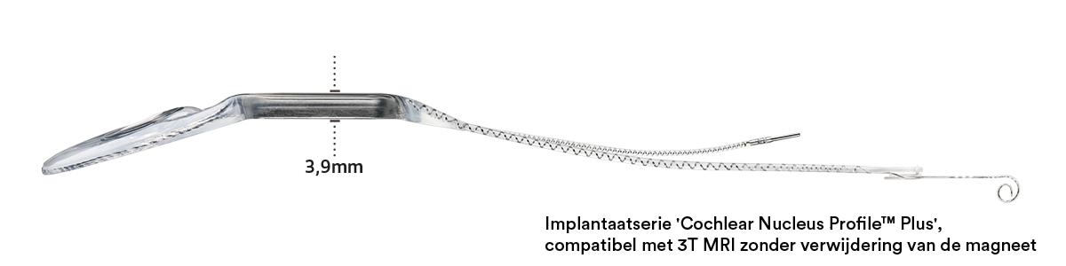 Cochlear Nucleus Profile™ Plus