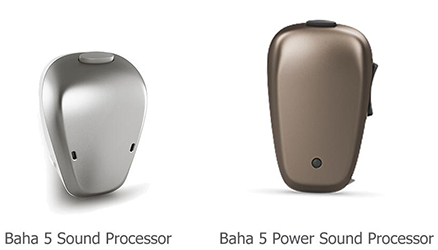 b5-retirement-sound-processors.jpg