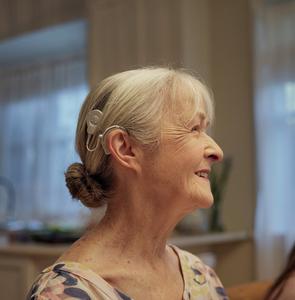 Frau mit einem Cochlea-Implantat