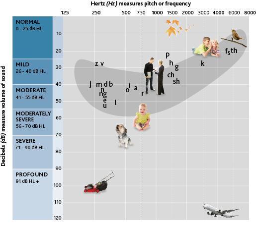 understand-audiograms_no-lines.png