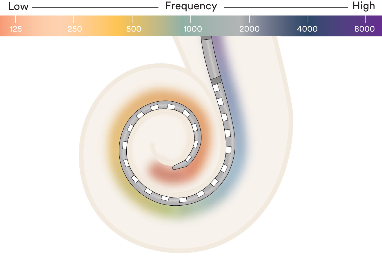 22+electrodes+for+greater+sound+resolution.png