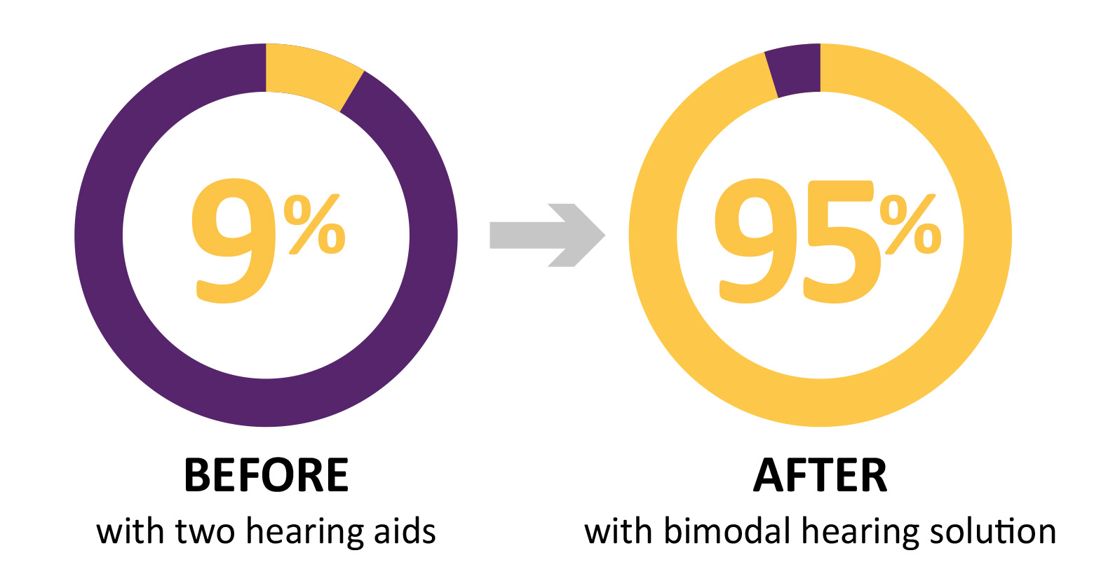 bimodal-hearing-solution