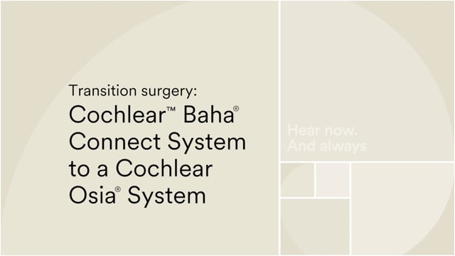 How to transition from a Cochlear™ Baha® Connect to a Cochlear™ Osia® 2 System