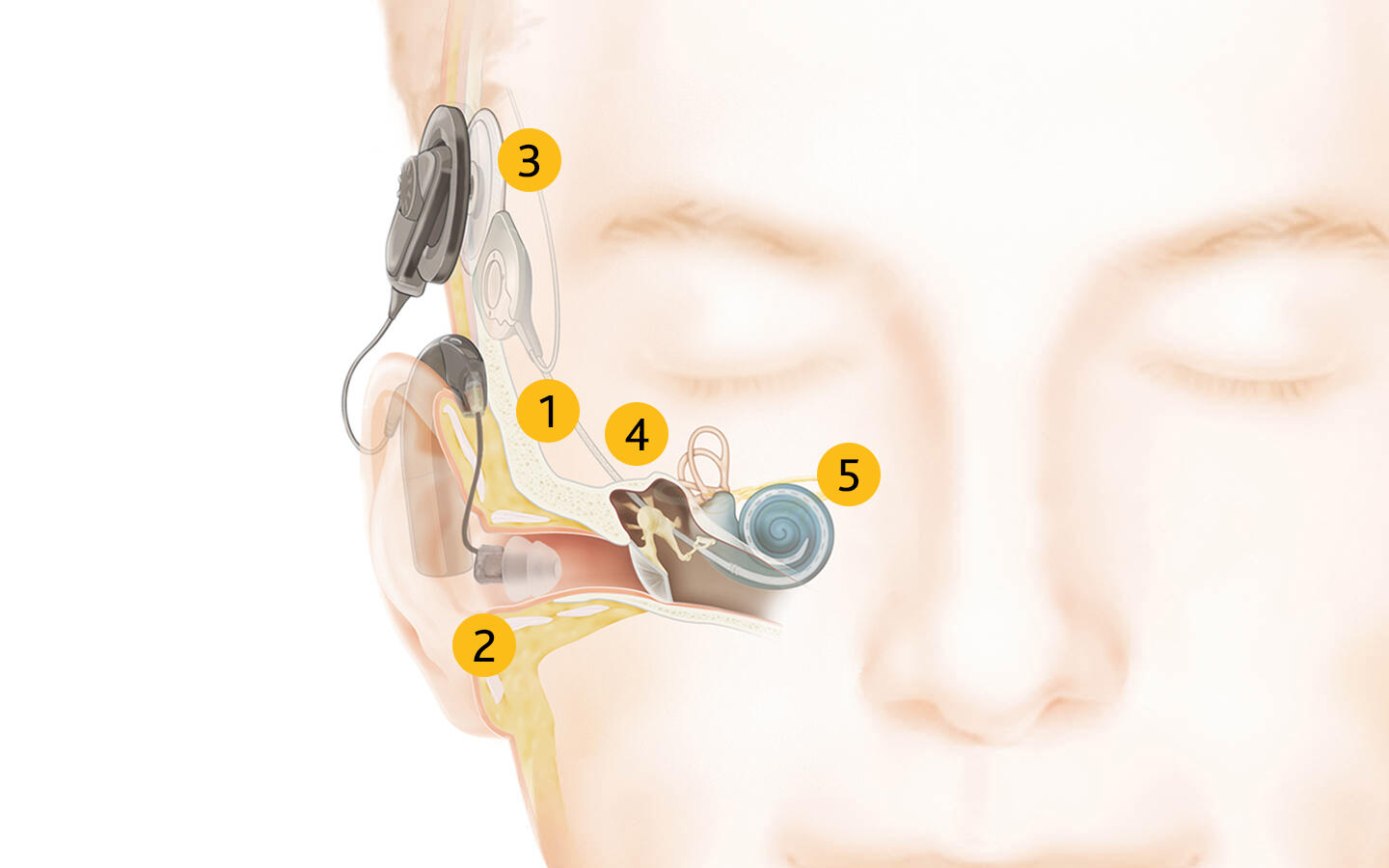 How-do-electro-acoustic-systems-work.jpg