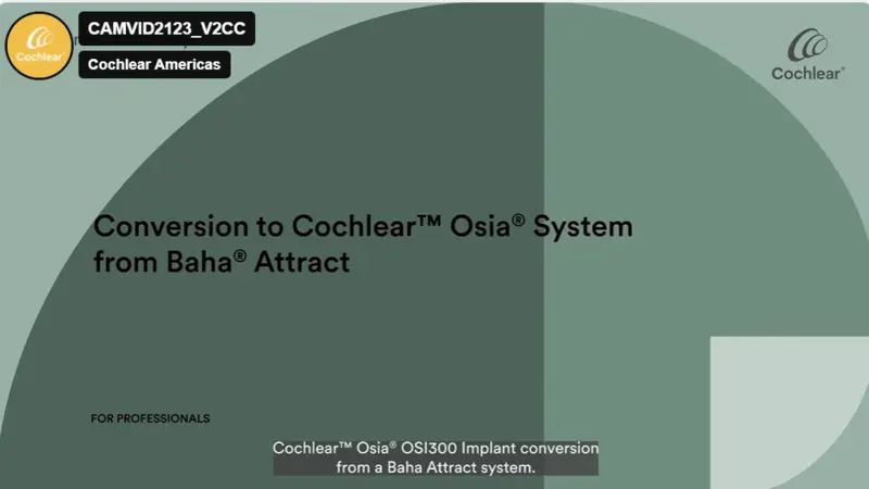 Conversion to Cochlear™ Osia® System from Baha® Attract
