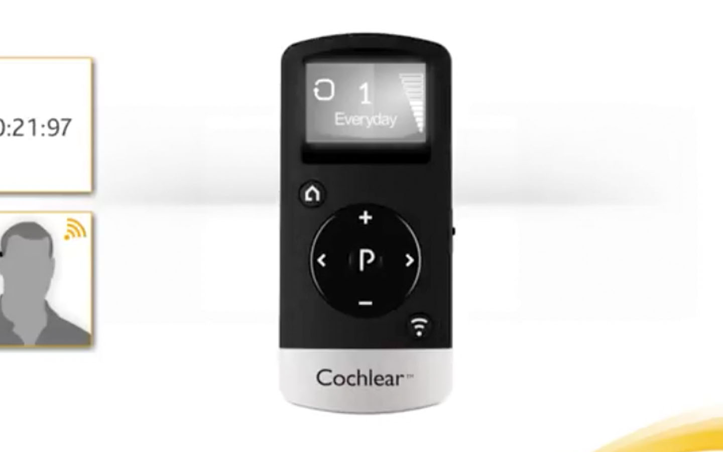 Baha コクレア リモートコントロール 2 Baha® リモートコントロール設定ガイド