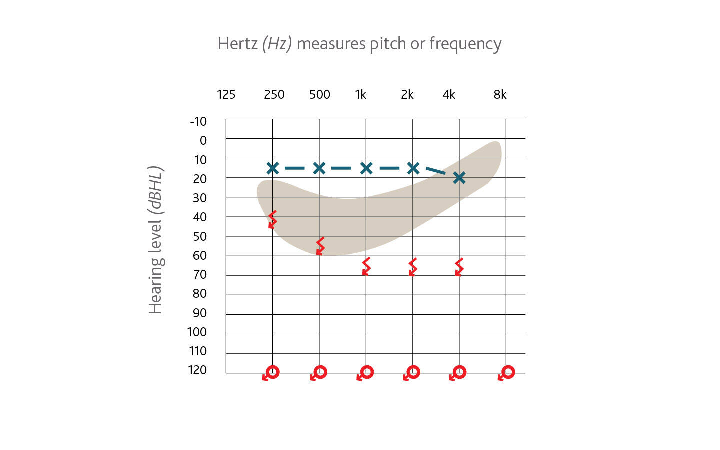 Audiogram example