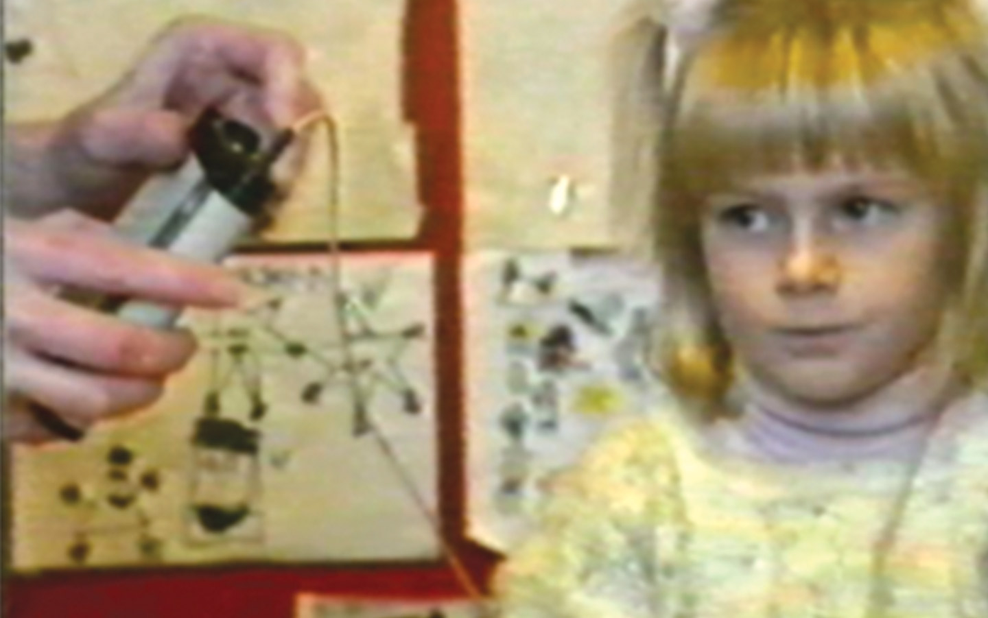 Första barnet som fick ett Nucleus-implantat, Holly McDonnell