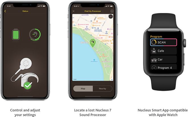 Nucleus Smart App with Apple Watch