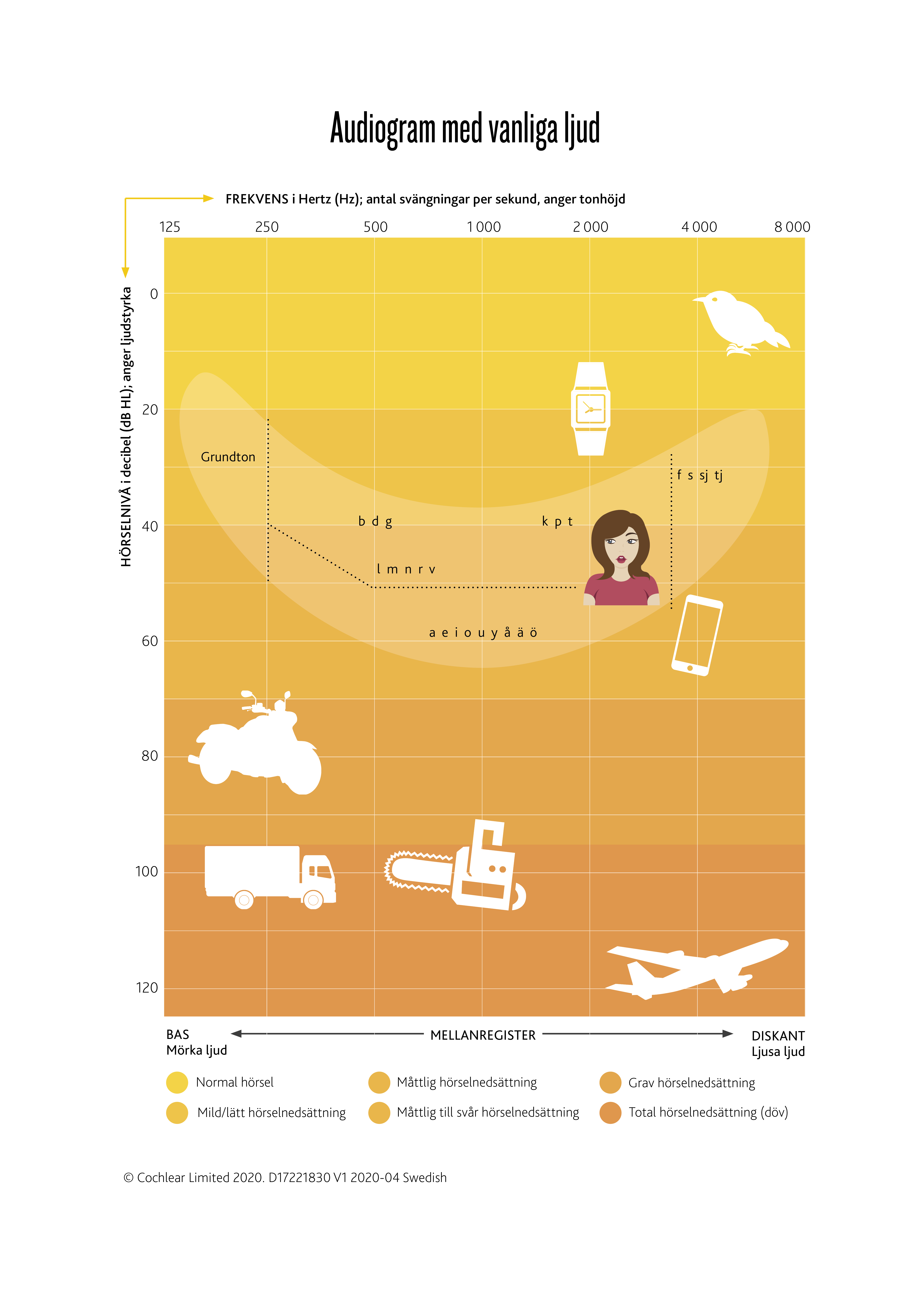 D17221830_V1_SV_Audiogram_A4_DCX_LC.png