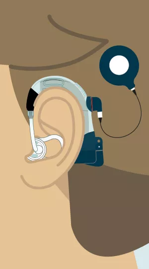 Ear Plug Retention.webp